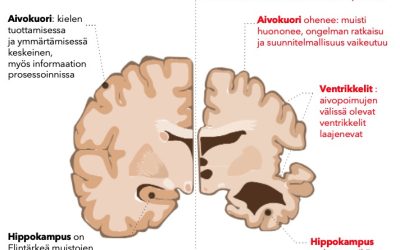 Miten muisti heikkenee ja inhimillinen toimintakyky rapautuu? Katsaus Alzheimerin taudin ja vaskulaarisen muistisairauden syntyyn